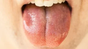 Mund mit ausgestreckter Zunge