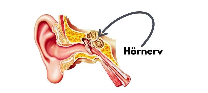 Hörnerv Symptome